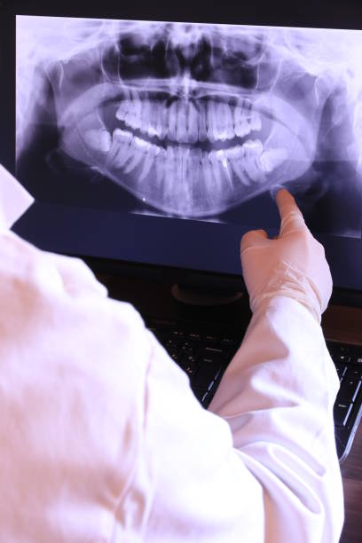 Best Knocked-Out Tooth Emergency  in Spanish Fork, UT